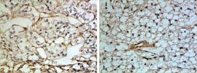 Immunohistochemistry-Paraffin: AGER Antibody (RM0127-2B65) [NBP1-22504] - The Kidney tissue samples from the Folic Acid induced kidney injury model were fixed using 4% PFA at 4C for overnight and embeded in paraffin. 4um section was sublected to IHC with NBP1-22504