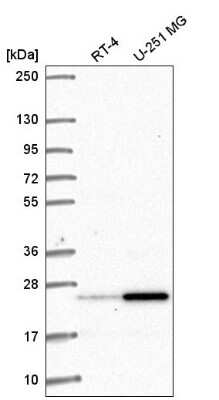Western Blot: AGER Antibody [NBP2-57198] - Western blot analysis in human cell line RT-4 and human cell line U-251 MG.