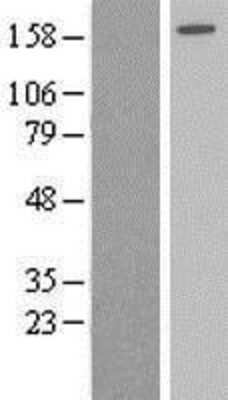 Western Blot: AGL Overexpression Lysate (Adult Normal) [NBP2-09003] Left-Empty vector transfected control cell lysate (HEK293 cell lysate); Right -Over-expression Lysate for AGL.