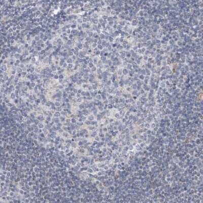 Immunohistochemistry-Paraffin: AGMAT Antibody [NBP1-82080] - Staining of human lymph node shows very weak cytoplasmic positivity in lymphoid cells.