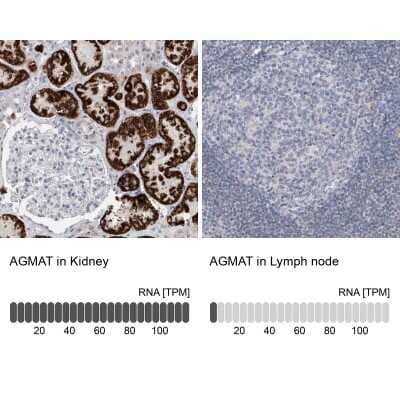 Immunohistochemistry-Paraffin: AGMAT Antibody [NBP1-82080] - Staining in human kidney and lymph node tissues.. Corresponding AGMAT RNA-seq data are presented for the same tissues.