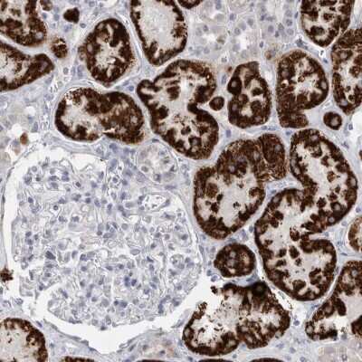 Immunohistochemistry-Paraffin: AGMAT Antibody [NBP1-82080] - Staining of human kidney shows strong granular cytoplasmic positivity in cells in tubules.