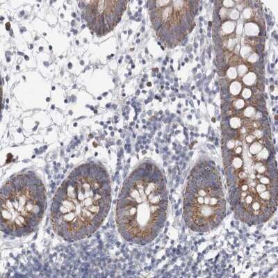 Immunohistochemistry-Paraffin: AGMAT Antibody [NBP1-82080] - Staining of human colon shows moderate granular cytoplasmic positivity in glandular cells.
