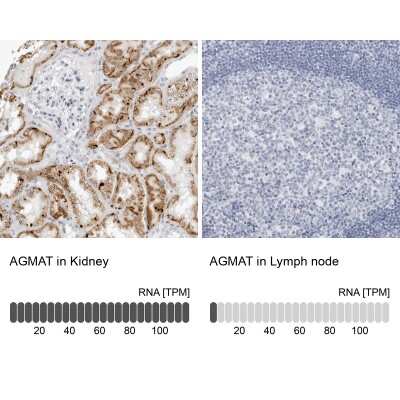 <b>Orthogonal Strategies Validation. </b>Immunohistochemistry-Paraffin: AGMAT Antibody [NBP1-82081] - Staining in human kidney and lymph node tissues using anti-AGMAT antibody. Corresponding AGMAT RNA-seq data are presented for the same tissues.