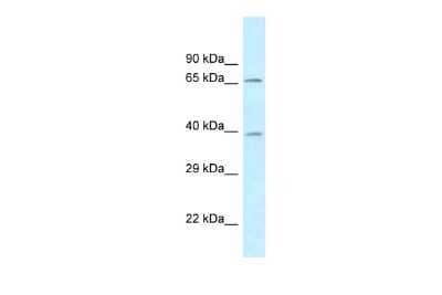Western Blot: AGMAT Antibody [NBP2-86962] - WB Suggested Anti-AGMAT Antibody. Titration: 1.0 ug/ml. Positive Control: Fetal Brain
