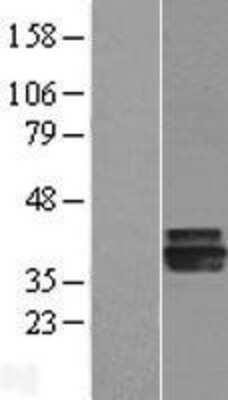 Western Blot AGMAT Overexpression Lysate
