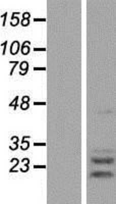 Western Blot: AGPAT2 Overexpression Lysate (Adult Normal) [NBP2-08687] Left-Empty vector transfected control cell lysate (HEK293 cell lysate); Right -Over-expression Lysate for AGPAT2.