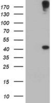 Western Blot: AGPAT5 Antibody (OTI2C4) - Azide and BSA Free [NBP2-72002] - HEK293T cells were transfected with the pCMV6-ENTRY control (Left lane) or pCMV6-ENTRY AGPAT5 (Right lane) cDNA for 48 hrs and lysed. Equivalent amounts of cell lysates (5 ug per lane) were separated by SDS-PAGE and immunoblotted with anti-AGPAT5.