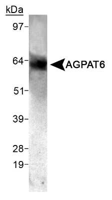 Western Blot: AGPAT6 Antibody [NB100-2389] - Detection of AGPAT6 in mouse skeletal muscle