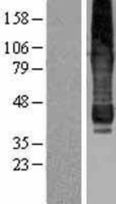 Western Blot AGPAT6 Overexpression Lysate