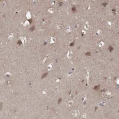 Immunohistochemistry-Paraffin AGPAT7 Antibody