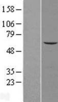 Western Blot: AGPAT7 Overexpression Lysate (Adult Normal) [NBL1-12651] Left-Empty vector transfected control cell lysate (HEK293 cell lysate); Right -Over-expression Lysate for AGPAT7.