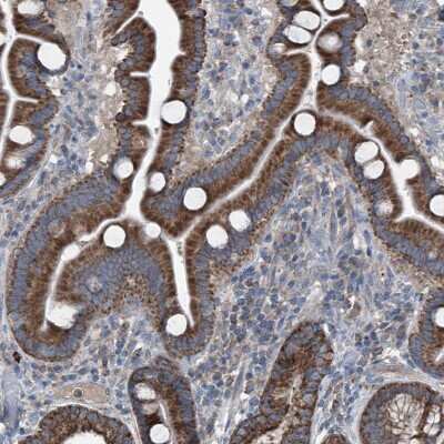 Immunohistochemistry-Paraffin AGPAT9 Antibody