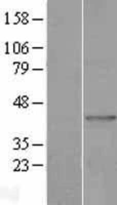 Western Blot: AGPAT9 Overexpression Lysate (Adult Normal) [NBP2-04404] Left-Empty vector transfected control cell lysate (HEK293 cell lysate); Right -Over-expression Lysate for AGPAT9.