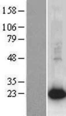 Western Blot: AG-2 Overexpression Lysate [NBP2-07625] - Left-Empty vector transfected control cell lysate (HEK293 cell lysate); Right -Over-expression Lysate for AGR2.