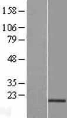 Western Blot: AG-3/AGR3 Overexpression Lysate [NBL1-07390] -  Left-Empty vector transfected control cell lysate (HEK293 cell lysate); Right -Over-expression Lysate for AGR3.