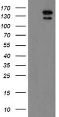 Western Blot: AGTPBP1 Antibody (1C8) [NBP2-03896] HEK293T cells were transfected with the pCMV6-ENTRY control (Left lane) or pCMV6-ENTRY AGTPBP1 (Right lane) cDNA for 48 hrs and lysed. Equivalent amounts of cell lysates (5 ug per lane) were separated by SDS-PAGE and immunoblotted with anti-AGTPBP1.