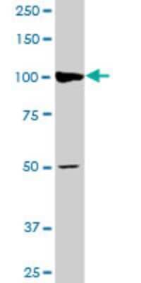 Western Blot: AGTPBP1 Antibody (2B9) [H00023287-M03] - Analysis of AGTPBP1 expression in HepG2 (Cat # L019V1).