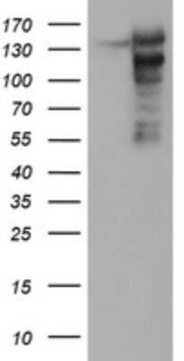 Western Blot: AGTPBP1 Antibody (9A3) [NBP2-46502] - Analysis of HEK293T cells were transfected with the pCMV6-ENTRY control (Left lane) or pCMV6-ENTRY AGTPBP1.