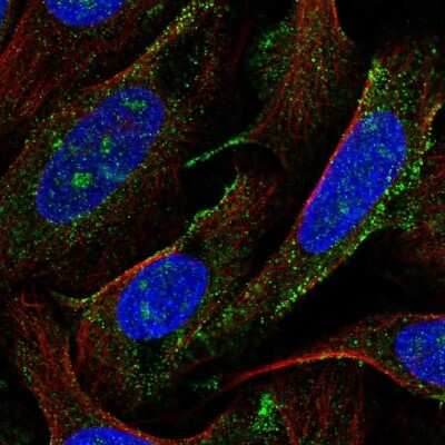 Immunocytochemistry/Immunofluorescence: AGTPBP1 Antibody [NBP2-31662] - Staining of human cell line U-2 OS shows localization to nucleoli & vesicles.