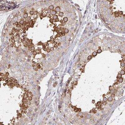 Immunohistochemistry-Paraffin: AGTPBP1 Antibody [NBP2-31662] - Staining of human testis shows strong cytoplasmic positivity in cells in seminiferus ducts.