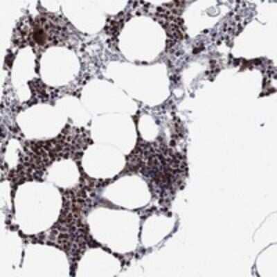 Immunohistochemistry-Paraffin: AGTPBP1 Antibody [NBP3-17647] - Staining of human bone marrow shows strong nuclear and cytoplasmic positivity in hematopoietic cells.