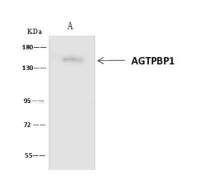 Immunoprecipitation: AGTPBP1 Antibody [NBP3-06124] - 