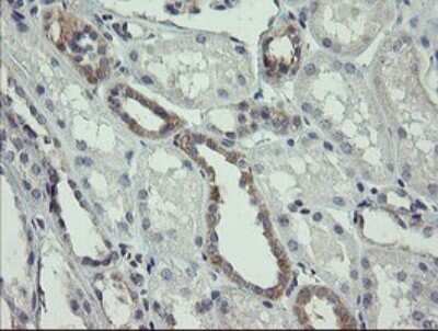 Immunohistochemistry: AGTPBP1 Antibody (OTI9A3) - Azide and BSA Free [NBP2-71734] - Analysis of Human Kidney tissue.