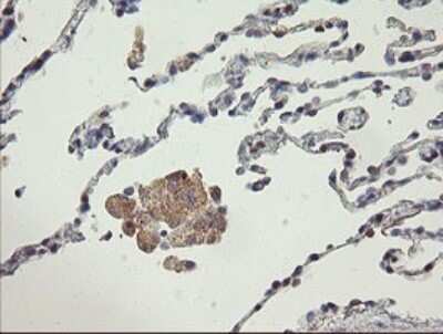 Immunohistochemistry: AGTPBP1 Antibody (OTI9A3) - Azide and BSA Free [NBP2-71734] - Analysis of Human lung tissue.