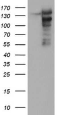Western Blot: AGTPBP1 Antibody (OTI9A3) - Azide and BSA Free [NBP2-71734] - Analysis of HEK293T cells were transfected with the pCMV6-ENTRY control (Left lane) or pCMV6-ENTRY AGTPBP1.