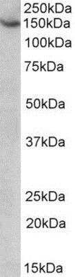 Western Blot: AGTPBP1 Antibody [NBP1-52106] - Analysis of AGTPBP1/NNA1 in HeLa lysate (35ug protein in RIPA buffer) using NBP1-52106 at 1ug/ml. Primary incubation was 1 hour. Detected by chemiluminescence.