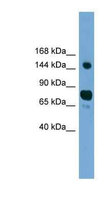 Western Blot: AGTPBP1 Antibody [NBP1-79579] - HepG2 cell lysate, concentration 0.2-1 ug/ml.