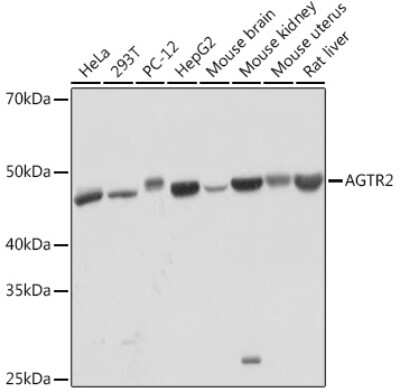 Western Blot: AGTR-2 Antibody (0V7Y3) [NBP3-16238] - Western blot analysis of extracts of various cell lines, using AGTR-2 Rabbit mAb (NBP3-16238) at 1:1000 dilution. Secondary antibody: HRP Goat Anti-Rabbit IgG (H+L) at 1:10000 dilution. Lysates/proteins: 25ug per lane. Blocking buffer: 3% nonfat dry milk in TBST. Detection: ECL Basic Kit. Exposure time: 1min.