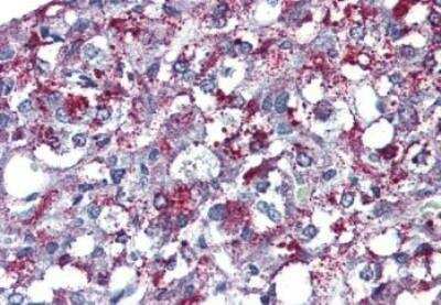Immunohistochemistry-Paraffin: AGTR-2 Antibody [NBP1-44282] - Analysis of anti-AGTR2 antibody with human adrenal.
