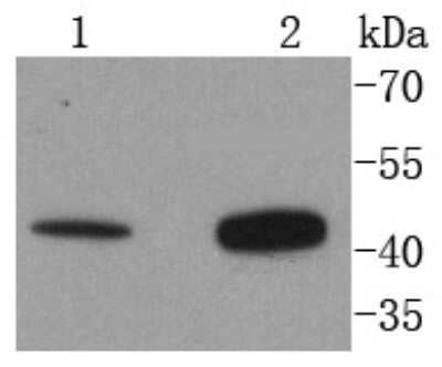Western Blot: AGTR-2 Antibody (SN71-03) [NBP2-67677] - Analysis of AGTR2 on different lysates using anti-AGTR2 antibody at 1/1,000 dilution. Positive control: Lane 1: 293T Lane 2: Hela