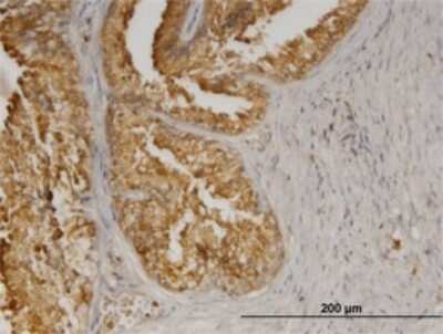 Immunohistochemistry-Paraffin: AGTRAP Antibody (1G2) [H00057085-M02] - Analysis of monoclonal antibody to AGTRAP on formalin-fixed paraffin-embedded human prostate. Antibody concentration 0.8 ug/ml.