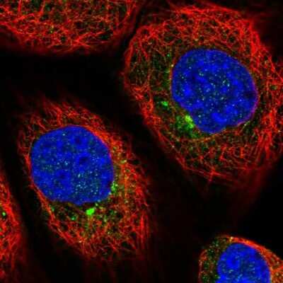 Immunocytochemistry/Immunofluorescence: AGTRAP Antibody [NBP1-91654] - Staining of human cell line A-431 shows positivity in vesicles.