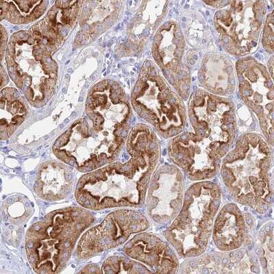 Immunohistochemistry-Paraffin: AGTRAP Antibody [NBP1-91654] - Staining of human kidney shows strong cytoplasmic positivity in renal tubules.