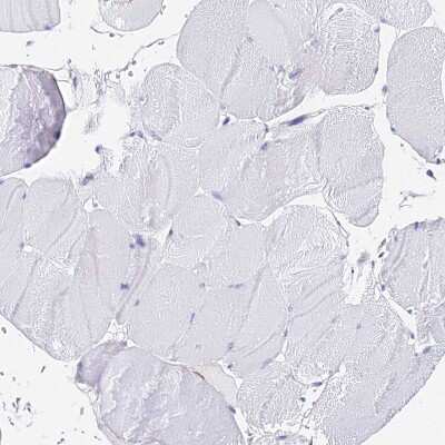 Immunohistochemistry-Paraffin: AGTRAP Antibody [NBP1-91654] - Staining of human Skeletal muscle shows no positivity in myocytes as expected.