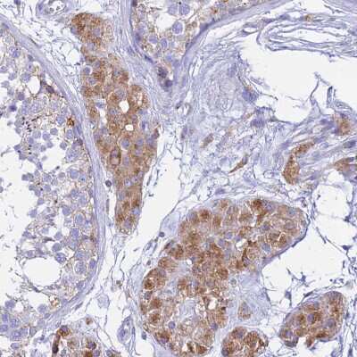 Immunohistochemistry-Paraffin: AGTRAP Antibody [NBP1-91654] - Staining of human Testis shows moderate cytoplasmic positivity in Leydig cells.