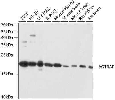 Western Blot: AGTRAP Antibody [NBP2-92060] - Analysis of extracts of various cell lines, using AGTRAP at 1:3000 dilution.Secondary antibody: HRP Goat Anti-Rabbit IgG (H+L) at 1:10000 dilution.Lysates/proteins: 25ug per lane.Blocking buffer: 3% nonfat dry milk in TBST.Detection: ECL Basic Kit .Exposure time: 10s.