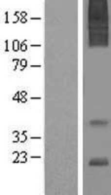 Western Blot: AGTRAP Overexpression Lysate (Adult Normal) [NBL1-07399] Left-Empty vector transfected control cell lysate (HEK293 cell lysate); Right -Over-expression Lysate for AGTRAP.