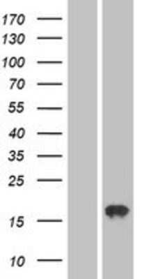 Western Blot: AGTRAP Overexpression Lysate (Adult Normal) [NBP2-04378] Left-Empty vector transfected control cell lysate (HEK293 cell lysate); Right -Over-expression Lysate for AGTRAP.