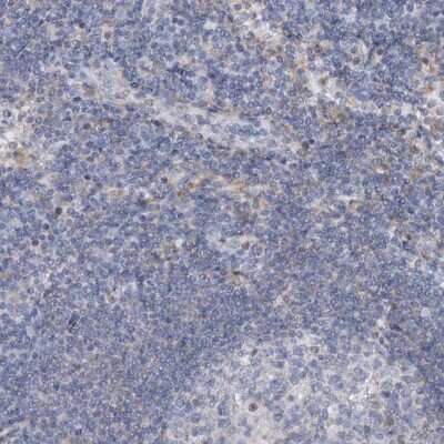 Immunohistochemistry-Paraffin: AGXT2 Antibody [NBP1-89199] - Staining of human lymph node shows low expression as expected.