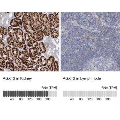 Immunohistochemistry-Paraffin: AGXT2 Antibody [NBP1-89199] - Staining in human kidney and lymph node tissues using anti-AGXT2 antibody. Corresponding AGXT2 RNA-seq data are presented for the same tissues.