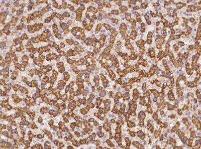 Immunohistochemistry-Paraffin: AGXT2 Antibody [NBP3-06037] - Immunochemical staining of human AGXT2 in human liver with rabbit polyclonal antibody at 1:500 dilution, formalin-fixed paraffin embedded sections.