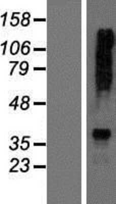 Western Blot: AGXT2 Overexpression Lysate (Adult Normal) [NBP2-06106] Left-Empty vector transfected control cell lysate (HEK293 cell lysate); Right -Over-expression Lysate for AGXT2.