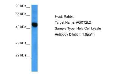 Western Blot AGXT2L2 Antibody - BSA Free