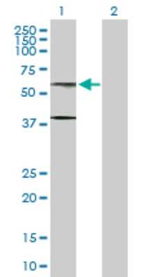 Western Blot: AHCYL1 Antibody [H00010768-D01P] - Analysis of AHCYL1 expression in transfected 293T cell line by AHCYL1 polyclonal antibody.Lane 1: AHCYL1 transfected lysate(59.00 KDa).Lane 2: Non-transfected lysate.