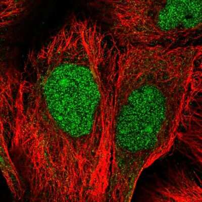 Immunocytochemistry/Immunofluorescence: AHDC1 Antibody [NBP1-84239] - Immunofluorescent staining of human cell line A-431 shows localization to nucleus & nucleoli.